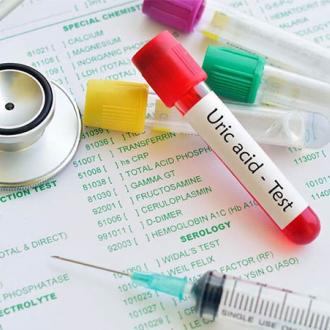 Axit uric: ý nghĩa lâm sàng chỉ số xét nghiệm uric acid