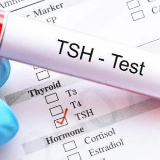 Ý nghĩa xét nghiệm TSH