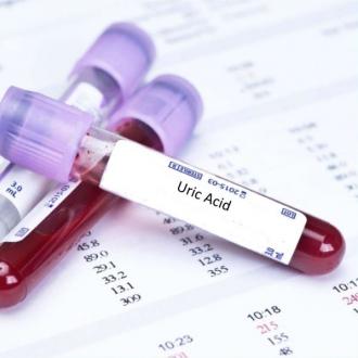 Nhận biết chỉ số acid uric bình thường