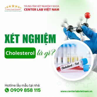 XÉT NGHIỆM CHOLESTEROL TOÀN PHẦN