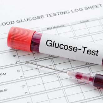 Xét nghiệm Glucose (đường huyết) là gì?