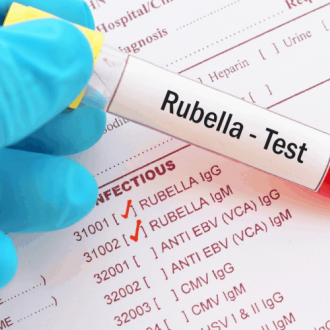Ý nghĩa của xét nghiệm Rubella