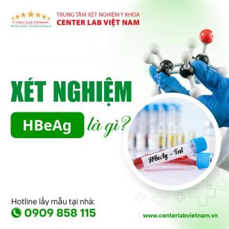 Ý NGHĨA XÉT NGHIỆM HBEAG